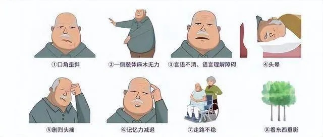 警惕身体发出的警报,脑中风的前兆有哪些症状 警惕身体发出的警报,脑中风的前兆有哪些症状